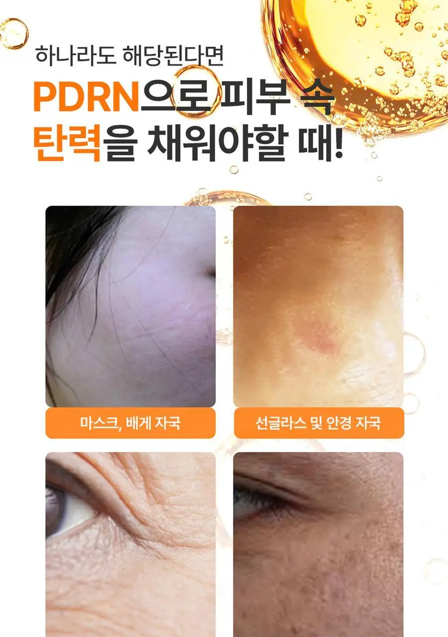 [탄력주름] 프랭클리 PDRN 바운스볼 광채세럼 30ml 앰플 상세페이지 4